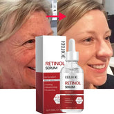 Home Wrinkle Removal Face Set with Firming Anti-Aging Serum and Eye Stick - Himpall